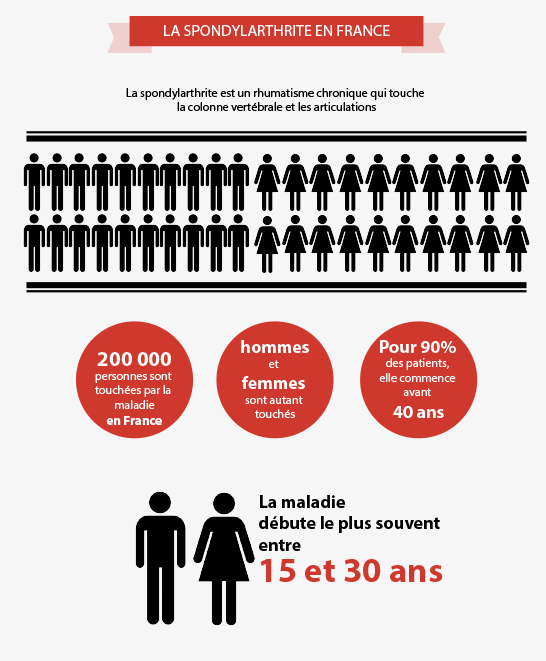 Les chiffres de la spondylarthrite en France