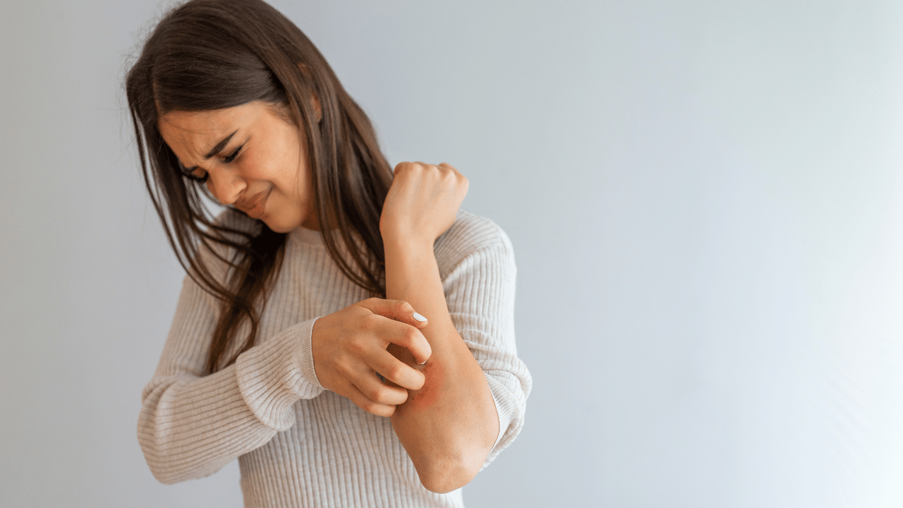 CBD et eczéma : flacon d'huile de CBD avec peau humaine malade
