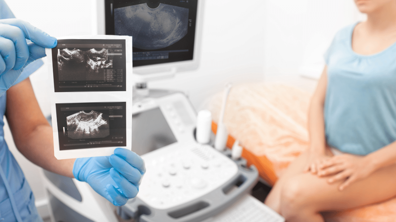 échographie gynécologique : image d'un professionnel de santé utilisant un échographe