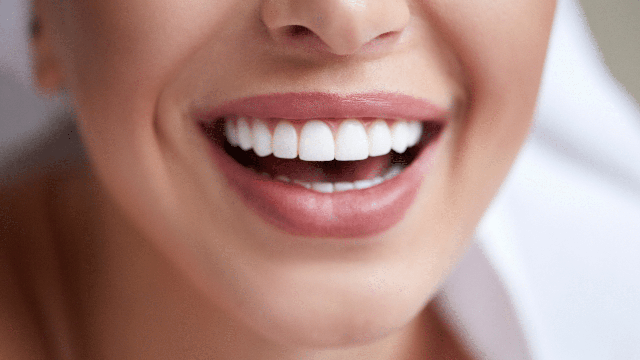 dents blanches : sourire éclatant avec des dents blanches et saines
