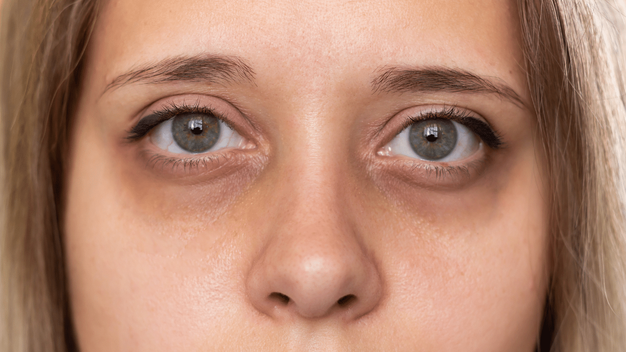 acupression : mains appliquant des pressions sur des points spécifiques du visage