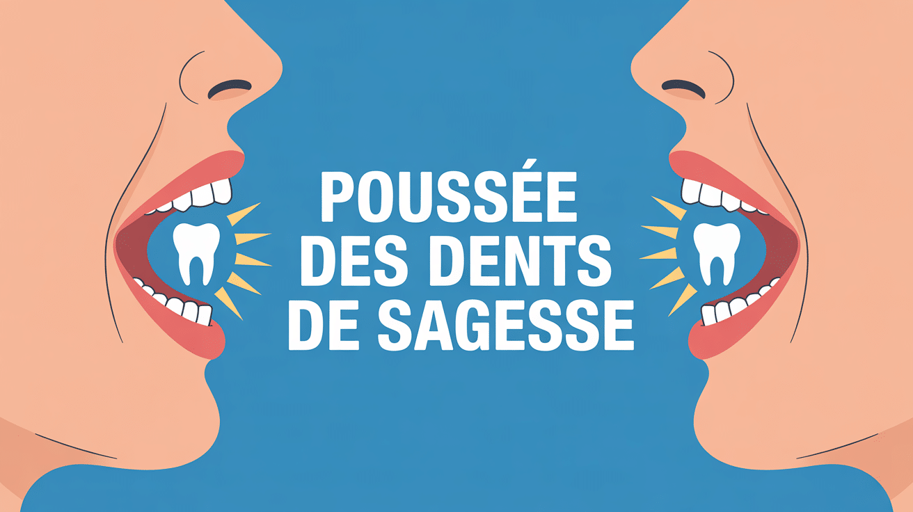 Illustration stylisée d'une bouche montrant la poussée d'une dent de sagesse